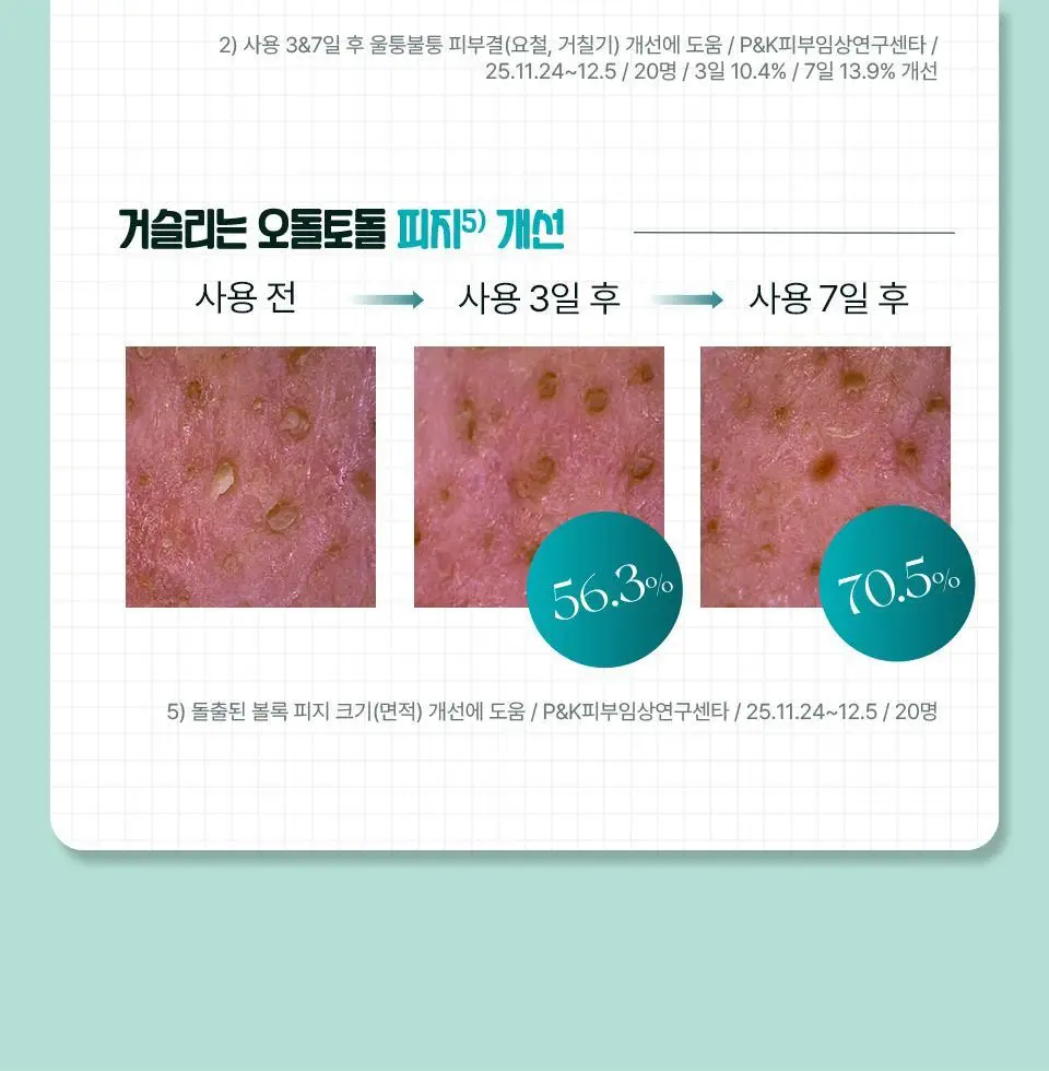 [NEW한정기획] 아이소이 브라이트닝 카밍 스팟 세럼 총 70ml 대용량 리필 기획 상세페이지 10